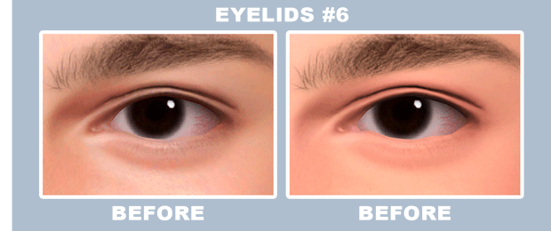 EYELIDS-#6.gif